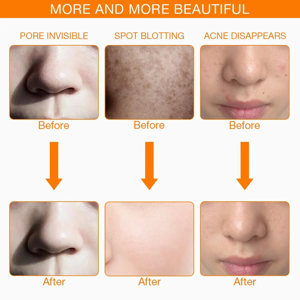 Iebilif LED Facial Phototherapy Mask For Skin Care